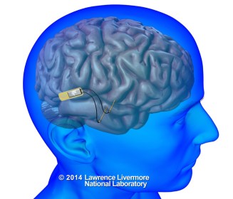 implantable-neural-device